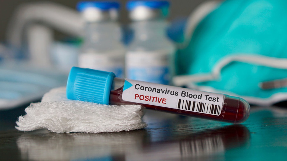 Update Virus Corona COVID-19: Korban Meninggal Bertambah Jadi 2.247