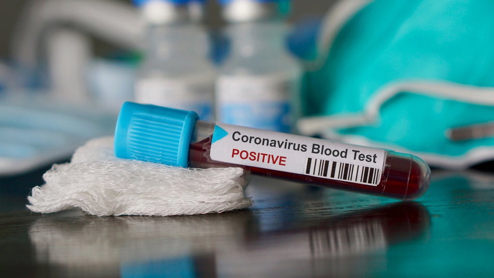 Apa Itu Rapid Test Coronavirus Deteksi Cepat COVID-19 di Indonesia
