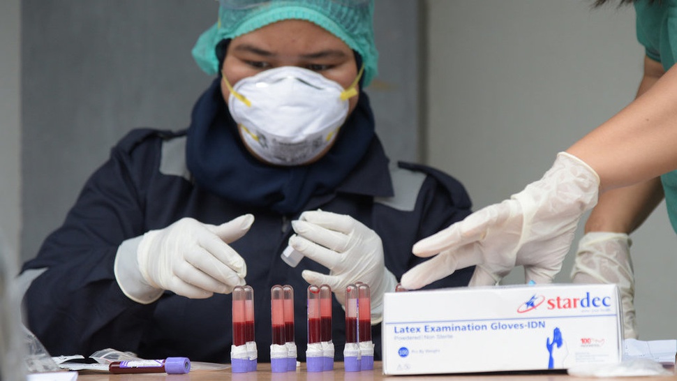 Ketahui Rapid Test PCR yang Akurat untuk Deteksi Virus COVID-19