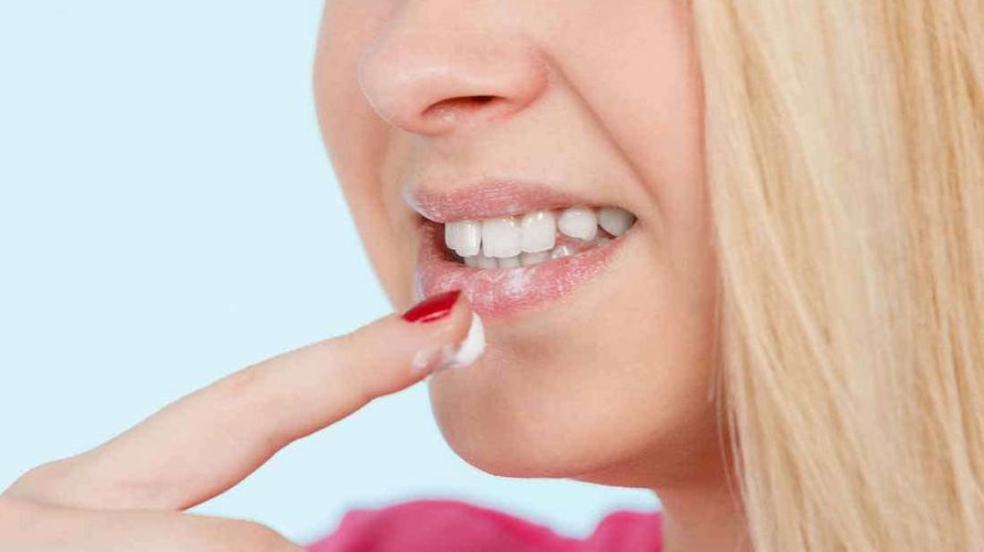 5 Cara Ampuh Mengatasi Bibir Kering & Pecah-pecah