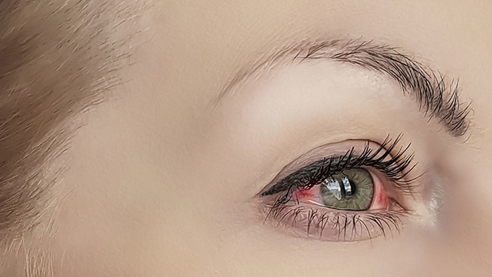 Fungsi Sklera pada Mata dan Ciri-ciri Kondisinya Normal