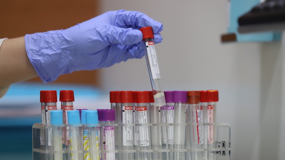 Pemerintah Pastikan Akan Evaluasi Tarif PCR yang Rugikan Masyarakat