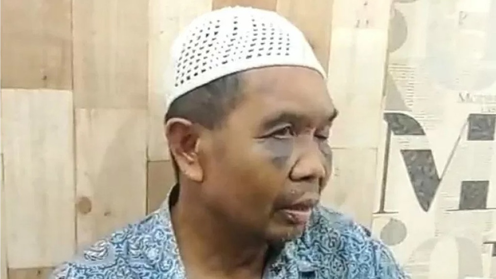 Kasus Polsek di Medan: 'Lingkaran Setan' Penyiksaan oleh Polisi