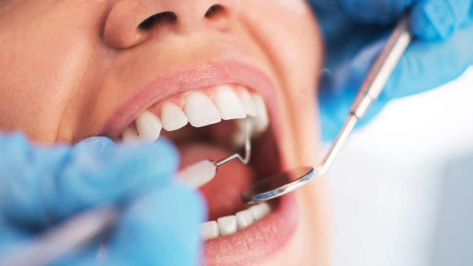 Dokter: Bakteri Mulut Bisa Sebabkan Sinusitis & Tips Merawat Gigi