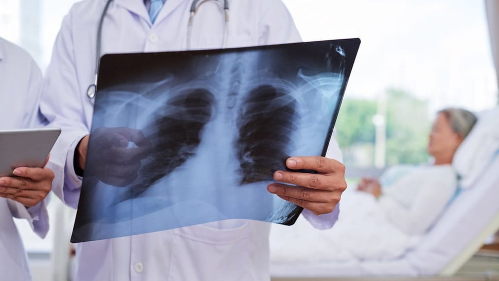 Permenkes Radiologi Rawan Bebani Sistem Kesehatan di Masa Pandemi