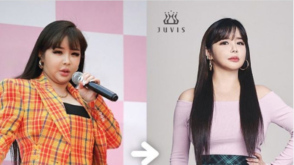 Park Bom eks 2NE1 Ungkap Siap Comeback & Keberhasilannya Diet Juvis