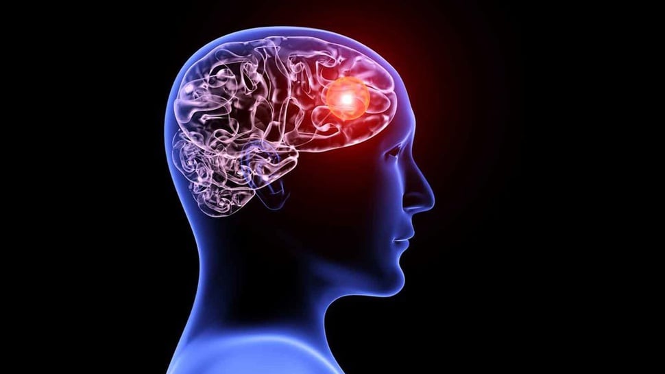 Studi: Serangan COVID-19 di Otak Membuat Penyakit Jadi Sangat Parah