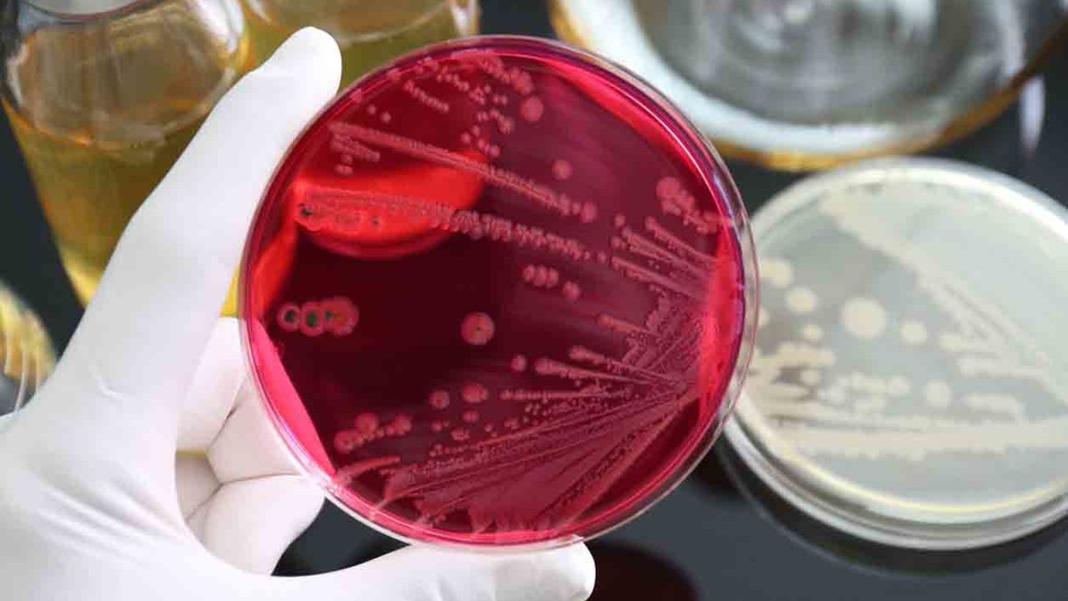 Apa Itu Bakteri Salmonella dan Risiko Penyakit yang Ditimbulkannya?