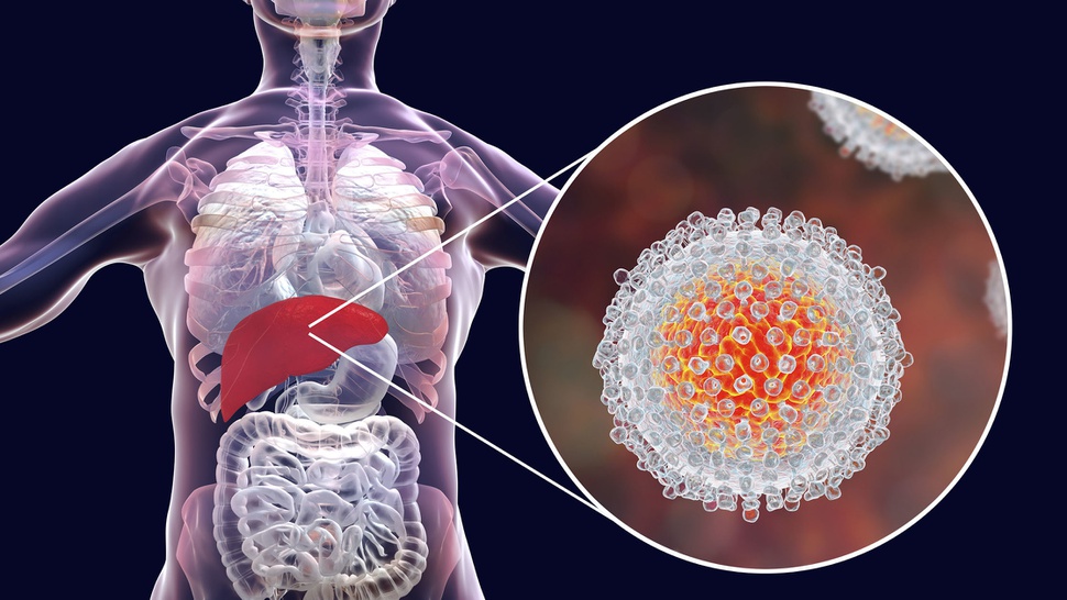 Virus Penyebab Hepatitis A & Ciri-ciri Sembuh dari Hepatitis A