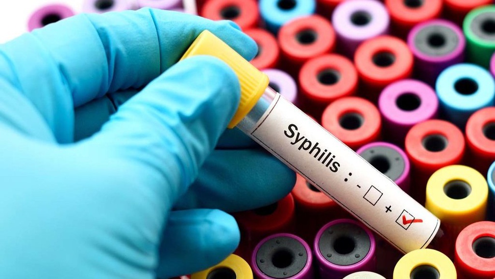 5 Tanda di Tubuh yang Tunjukkan Gejala IMS Sifilis, Apa Saja?