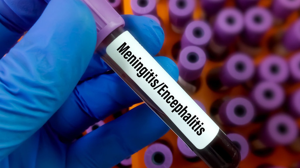 Syarat Vaksin Meningitis bagi Jemaah Umrah Ikuti Aturan Kemenag