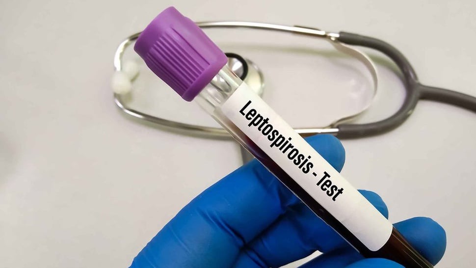 Leptospirosis Apakah Bisa Sembuh & Bagaimana Perawatannya?
