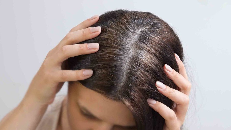 4 Tips Memperlambat Munculnya Rambut Uban & Ketahui Penyebabnya