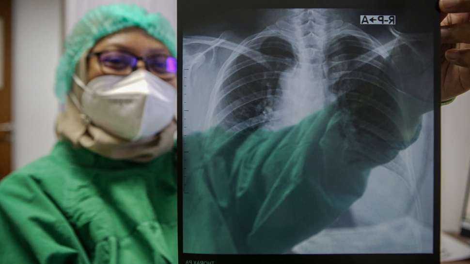 Hambatan Penanganan TBC di Indonesia Menurut BPJS Kesehatan
