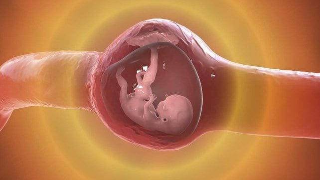 Apa Itu Kehamilan Ektopik yang Viral di Medsos, Bahaya, Penyebab