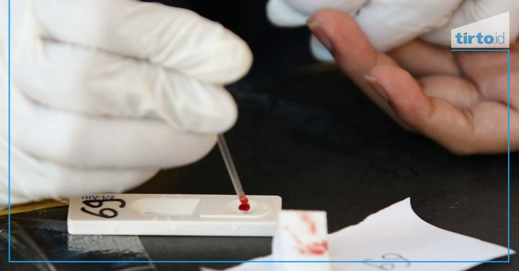 Biaya Pemeriksaan HIV/AIDS di Jakarta dan Daftar Lokasinya