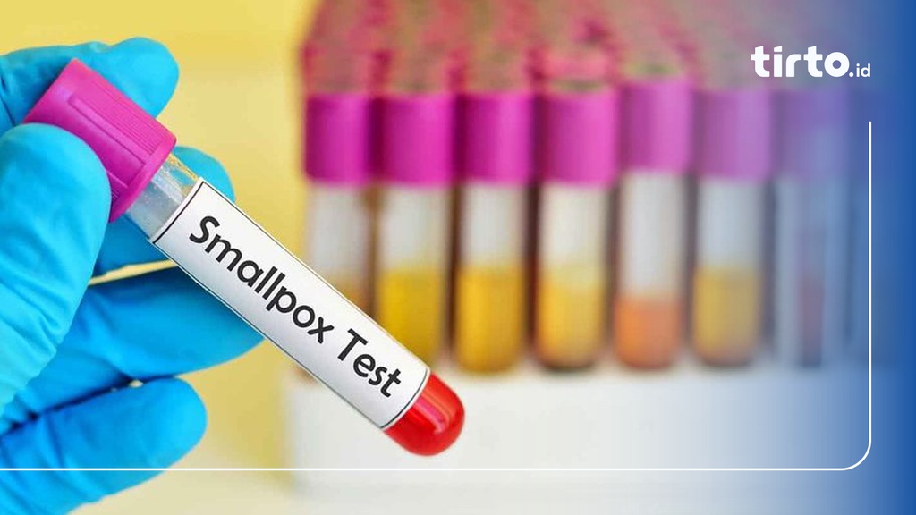 Usia Berapa Pemberian Vaksin Cacar Air pada Anak & Efek Sampingnya