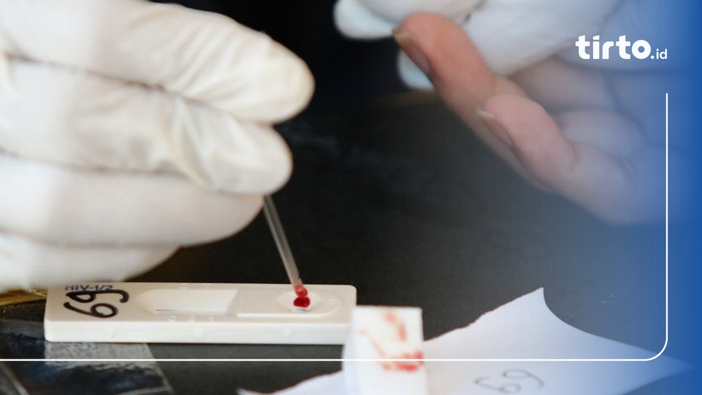 Berapa Harga Pemeriksaan HIV/AIDS dan Prosedurnya?