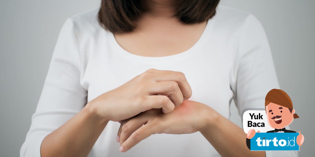 Mengenal Pioderma Gangrenosum Kelainan Kulit Yang Sebabkan Borok Tirto Id Mengenal Pioderma Gangrenosum Kelainan Kulit Yang Sebabkan Borok Tirto Id