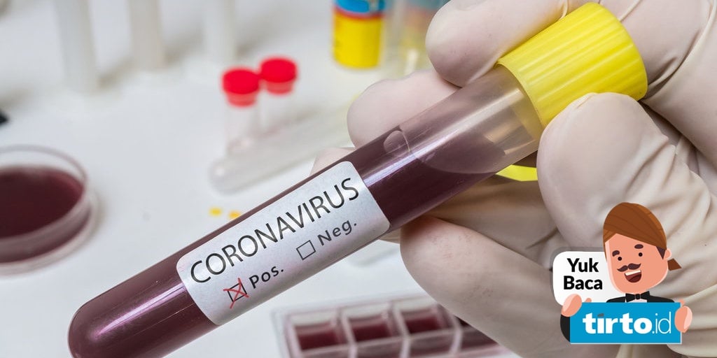 Cara Cegah Penyebaran Virus Corona Covid 19 Selalu Cuci Tangan Tirto Id