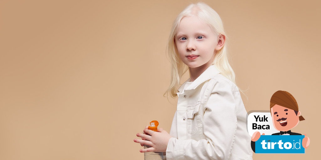 Mengenal Albinisme 5 Tipe Albino Dan Penyebabnya Tirto Id