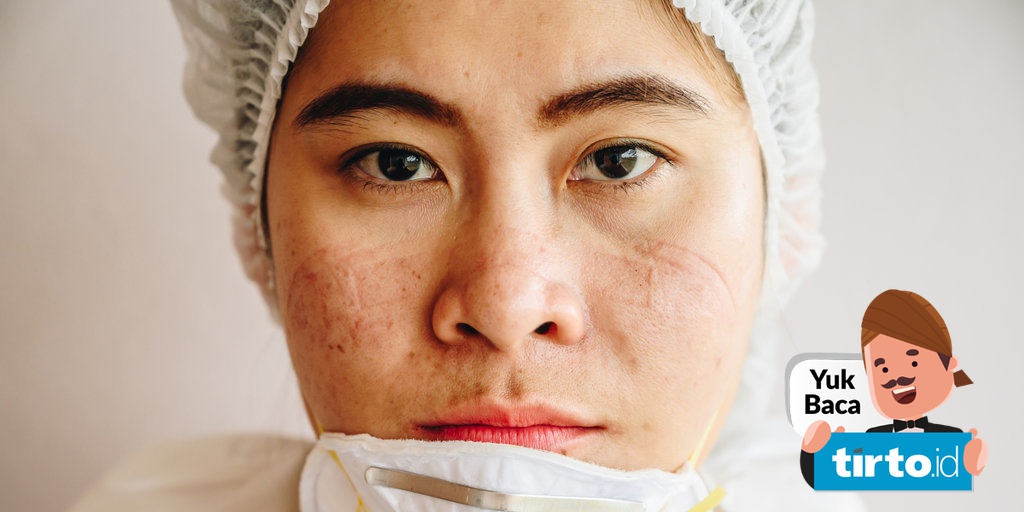 Penyebab Dan Solusi Jerawat Akibat Pakai Masker Menurut Dokter Tirto Id Penyebab Dan Solusi Jerawat Akibat Pakai Masker Menurut Dokter Tirto Id