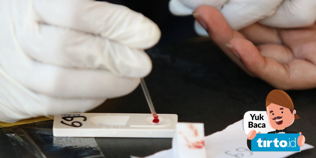 Berapa Harga Pemeriksaan HIV/AIDS dan Prosedurnya?